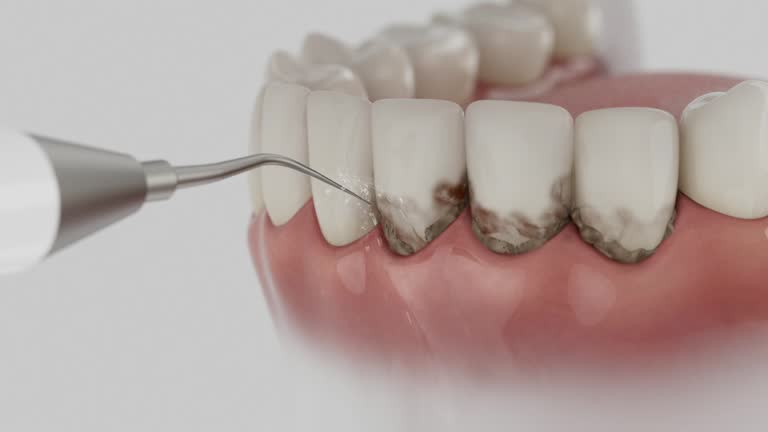 Trusted Dental Crowns And Bridges service in Fox Farm-College, WY - Dentist Open Now